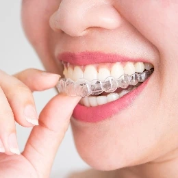 Orthodontic treatment treatment, illustrative photo